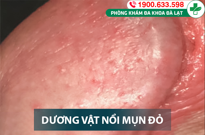 Hình ảnh minh họa